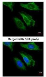 FGF21 Polyclonal Antibody