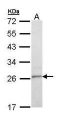 TSPAN6 Polyclonal Antibody