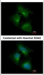 CDK5RAP1 Polyclonal Antibody