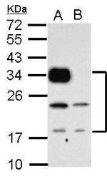 CD74 Antibody in Western Blot (WB)