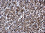 RPL17 Antibody in Immunohistochemistry (Paraffin) (IHC (P))