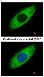 RPS3A Polyclonal Antibody
