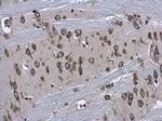 RPS3A Antibody in Immunohistochemistry (Paraffin) (IHC (P))