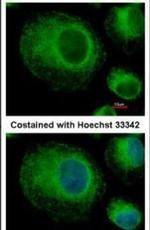 BAP31 Antibody in Immunocytochemistry (ICC/IF)