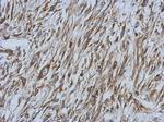 BAP31 Antibody in Immunohistochemistry (Paraffin) (IHC (P))
