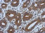BAP31 Antibody in Immunohistochemistry (Paraffin) (IHC (P))