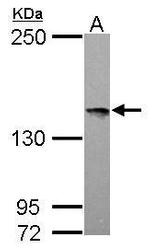 LOK Antibody in Western Blot (WB)