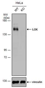 LOK Antibody in Western Blot (WB)