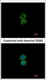 PIP5K1A Polyclonal Antibody