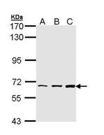 PIP5K1A Antibody in Western Blot (WB)
