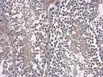 MELK Antibody in Immunohistochemistry (Paraffin) (IHC (P))