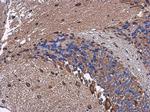 MELK Antibody in Immunohistochemistry (Paraffin) (IHC (P))