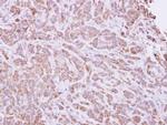 MELK Antibody in Immunohistochemistry (Paraffin) (IHC (P))