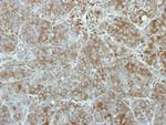 TEX14 Polyclonal Antibody