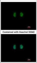 IPPK Polyclonal Antibody