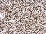 SNIP1 Antibody in Immunohistochemistry (Paraffin) (IHC (P))
