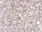 SNIP1 Polyclonal Antibody