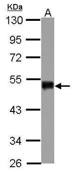 SNIP1 Antibody in Western Blot (WB)
