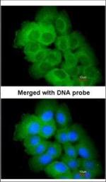 STK32C Polyclonal Antibody