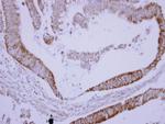 SAB Antibody in Immunohistochemistry (Paraffin) (IHC (P))