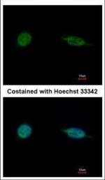 SAP30BP Polyclonal Antibody
