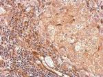 TIMP1 Antibody in Immunohistochemistry (Paraffin) (IHC (P))