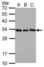 TIMP1 Antibody in Western Blot (WB)