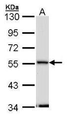 Septin-11 Polyclonal Antibody