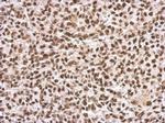 SFPQ Polyclonal Antibody