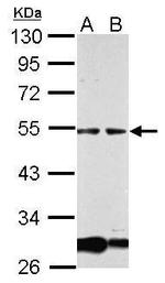 GCM1 Polyclonal Antibody