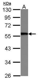 SERBP1 Polyclonal Antibody