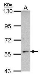 CYP21A2 Polyclonal Antibody