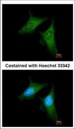 beta COP Antibody in Immunocytochemistry (ICC/IF)