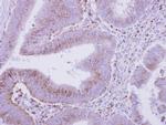 beta COP Antibody in Immunohistochemistry (Paraffin) (IHC (P))