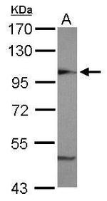 beta COP Antibody in Western Blot (WB)