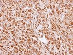Calreticulin 3 Antibody in Immunohistochemistry (Paraffin) (IHC (P))