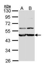 Calreticulin 3 Antibody in Western Blot (WB)
