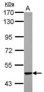Cytokeratin 23 Polyclonal Antibody