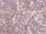 RPL4 Antibody in Immunohistochemistry (Paraffin) (IHC (P))