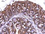 RPL4 Antibody in Immunohistochemistry (Paraffin) (IHC (P))