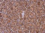 RPL4 Antibody in Immunohistochemistry (Paraffin) (IHC (P))