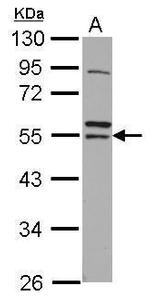 RNF14 Antibody in Western Blot (WB)