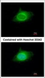 KPNA5 Polyclonal Antibody