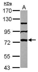 MPP10 Polyclonal Antibody