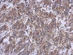HERPUD1 Polyclonal Antibody