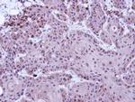 SUV39H1 Antibody in Immunohistochemistry (Paraffin) (IHC (P))
