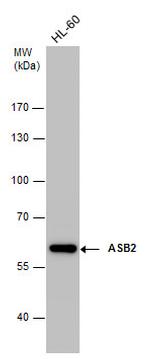 ASB2 Antibody in Western Blot (WB)