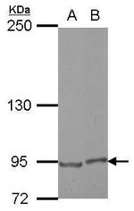 E2F8 Polyclonal Antibody