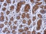 UPF1 Polyclonal Antibody