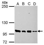 PDE3A Polyclonal Antibody